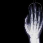 X-ray Photography new wallpapers