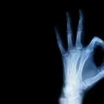 X-ray Photography wallpapers hd