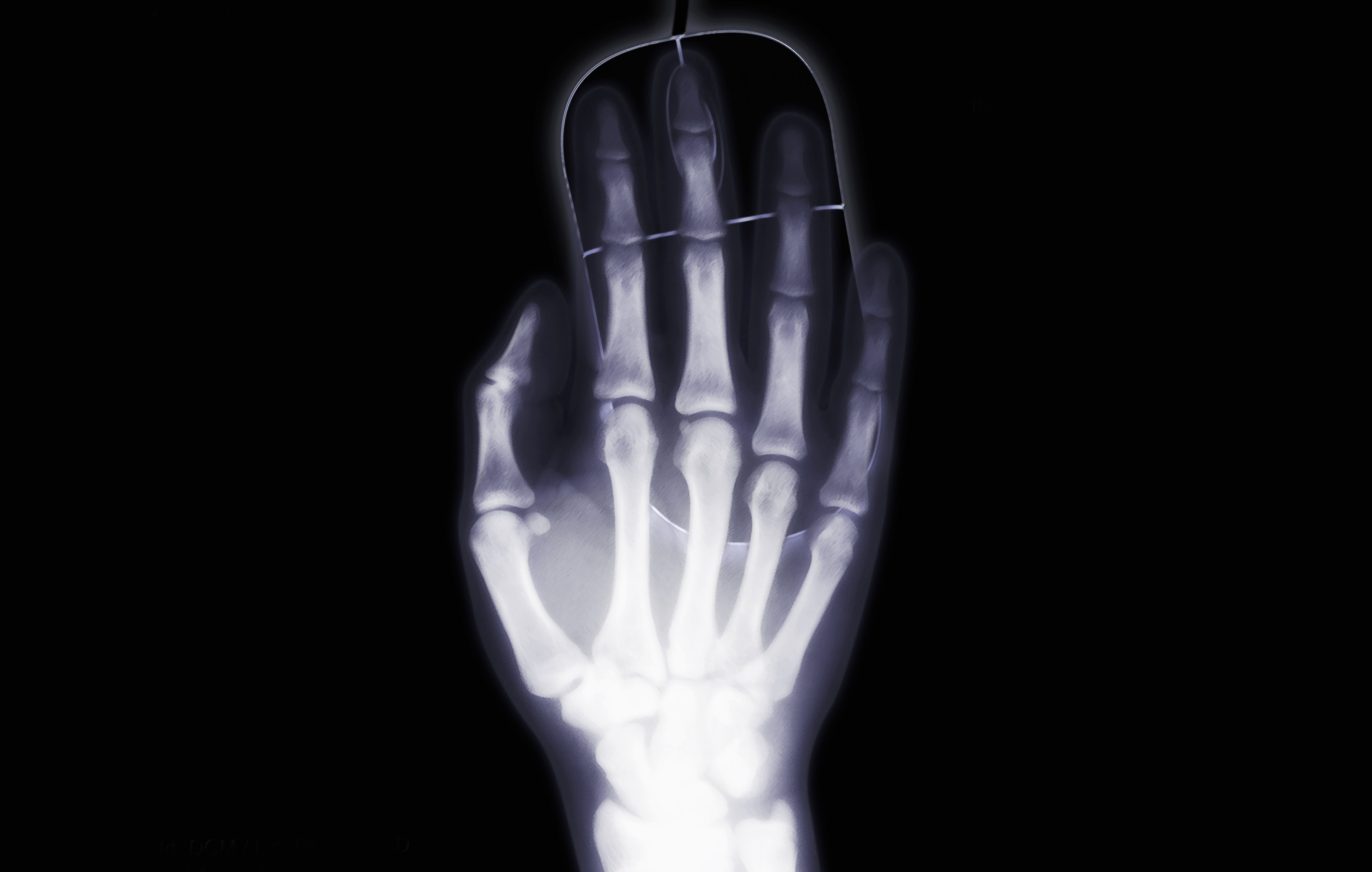 Mouse (computer) X-ray Vision Black Humor Minimalist Hand Bones Photography X-ray 8k Ultra wallpapers HD quality
