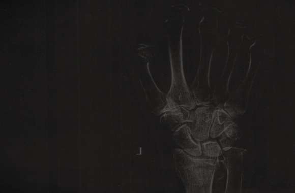 Xray wallpapers hd quality